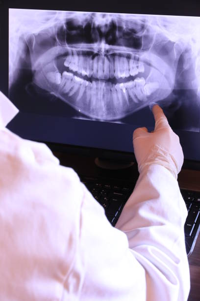 Best Emergency Dental Care for Sports Injuries in Clarkdale, AZ