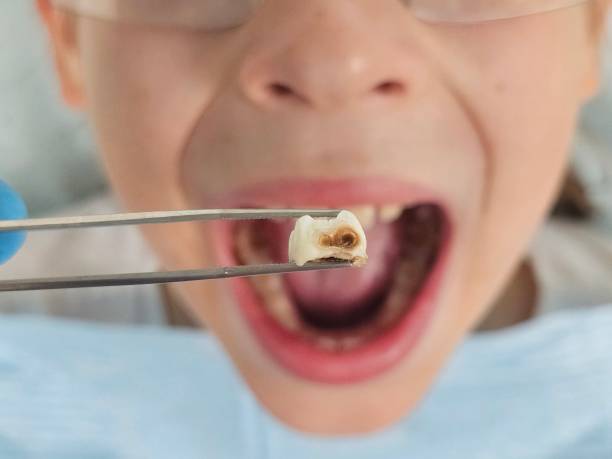 Best Broken or Chipped Tooth Repair in Clarkdale, AZ
